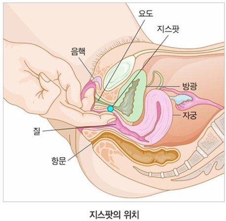 G-SPOT 성형